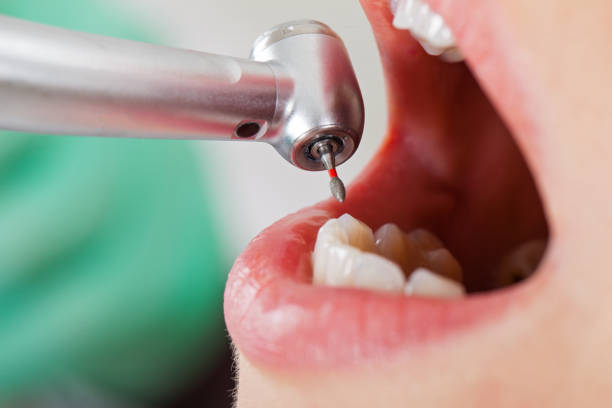 Best Walk-In Emergency Dentist in Sand Hill, PA